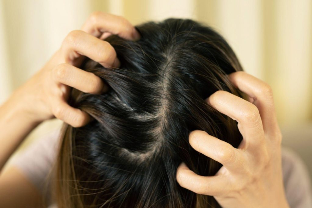 Woman massages her scalp with her fingers